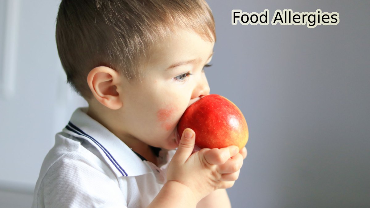 Food Allergies and Intolerances and Overweight