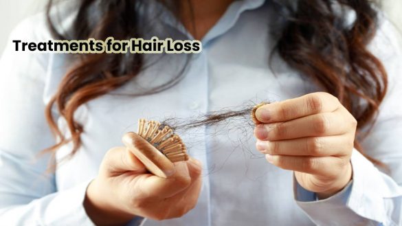 Treatments for Hair Loss