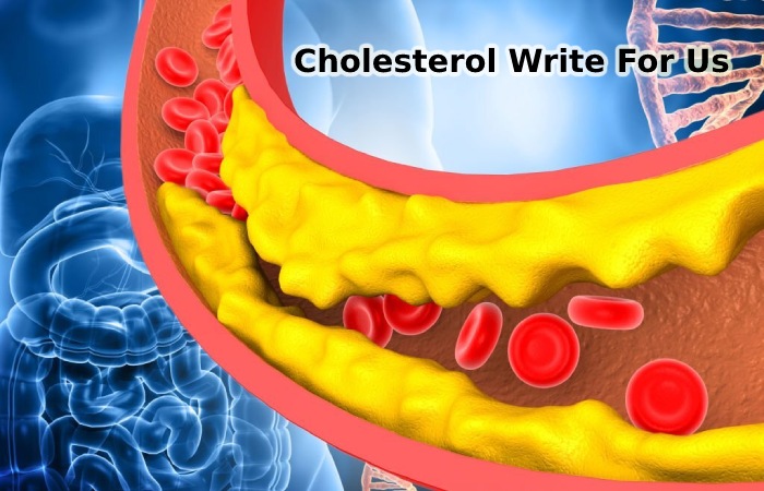 Cholesterol Write For Us