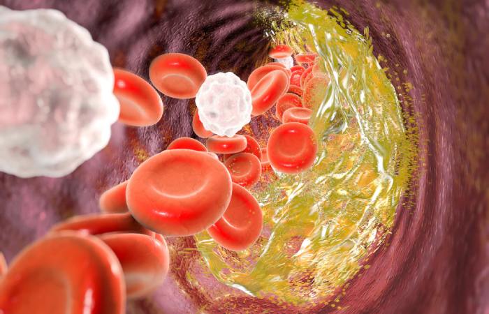 Cholesterol Write for Us